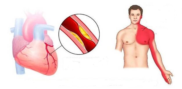 Cardiac